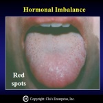 Red dots tongue