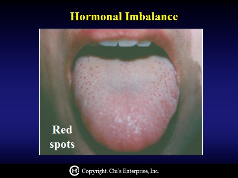 Red dots tongue