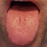 Tongue 2